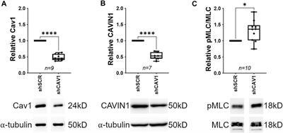 A Role of Caveolae in Trabecular Meshwork Mechanosensing and Contractile Tone